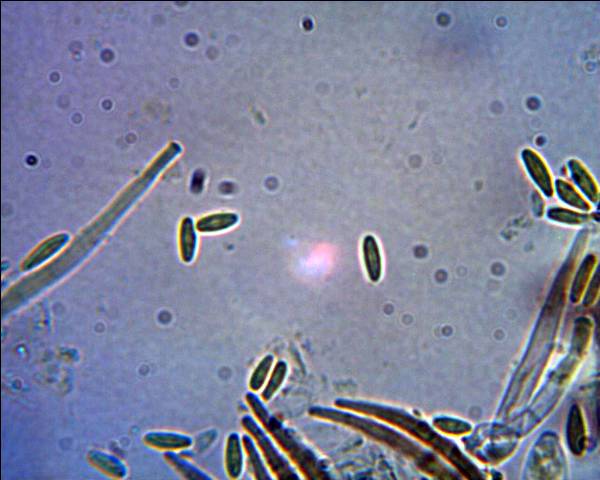 Lachnum virgineum (Batsch:Fr.)P.Karst.